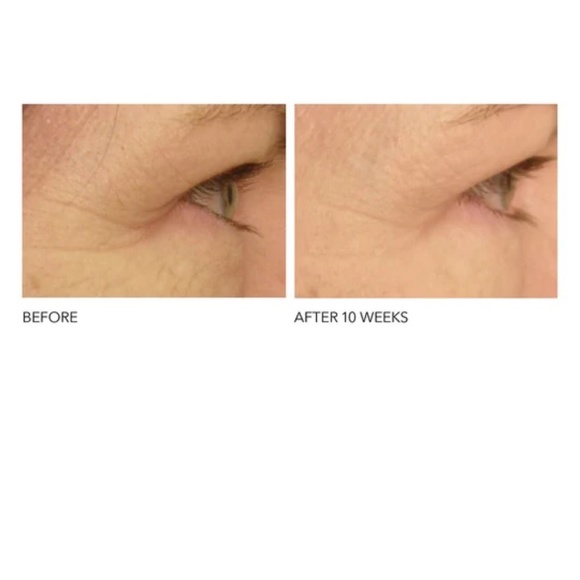 Dr. Dennis Gross DRX SpectraLite EyeCare Pro LED Mask - Very Clean! - Picture 9 of 9